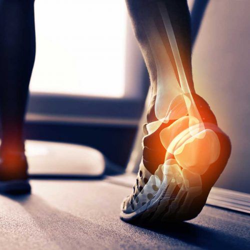 Relief for Osteoarthritis Pain